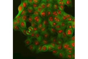 IF analysis of SURF2 using anti-SURF2 antibody (ABIN7602318) and anti-Tubulin Alpha antibody (ABIN7600339).