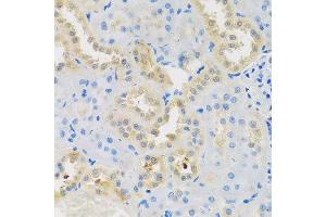 Immunohistochemistry of paraffin-embedded rat kidney using DNAL1 antibody at dilution of 1:100 (x40 lens). (DNAL1 抗体)