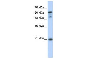 GCET2 antibody used at 1 ug/ml to detect target protein. (GCET2 抗体  (Middle Region))
