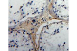 Used in DAB staining on fromalin fixed paraffin-embedded testis tissue (Insulin Like Protein 3 (AA 2-129) 抗体)