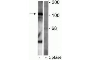 Western blot of rat synaptic membrane lysate showing specific immunolabeling of the ~102 kDa GABAB R1 protein phosphorylated at Ser923 in the first lane (-). (GABBR1 抗体  (pSer923))