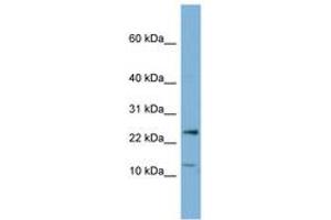 Image no. 1 for anti-Protein Phosphatase 1, Regulatory (Inhibitor) Subunit 11 (PPP1R11) (N-Term) antibody (ABIN6741758) (PPP1R11 抗体  (N-Term))
