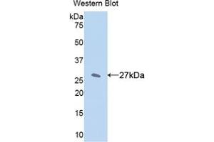 Western blot analysis of the recombinant protein. (CYP1A2 抗体  (AA 2-231))