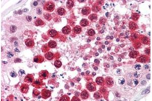 Human Testis: Formalin-Fixed, Paraffin-Embedded (FFPE)