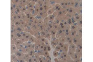 Used in DAB staining on fromalin fixed paraffin- embedded liver tissue (PHF8 抗体  (AA 195-351))