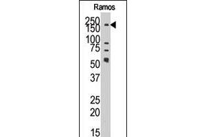 Western blot analysis of KDM3B polyclonal antibody  in Ramos cell line lysate. (KDM3B 抗体  (N-Term))