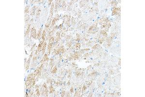 Immunohistochemistry of paraffin-embedded mouse heart using PDK4 Rabbit pAb (ABIN6132477, ABIN6145396, ABIN6145397 and ABIN6217290) at dilution of 1:100 (40x lens). (PDK4 抗体  (AA 102-411))