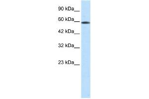 WB Suggested Anti-ASH2L Antibody Titration:  0. (ASH2L 抗体  (N-Term))