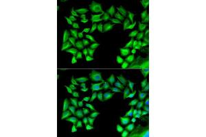 Immunofluorescence analysis of U2OS cells using TIMP4 antibody. (TIMP4 抗体  (AA 30-224))