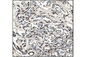 IHC analysis of TAGLN/Transgelin using anti-TAGLN/Transgelin antibody (ABIN7600099). (Transgelin 抗体  (AA 15-170))