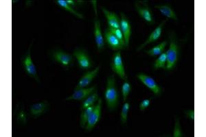 Immunofluorescence staining of Hela cells with ABIN7143601 at 1:133, counter-stained with DAPI. (AGRN 抗体  (AA 968-1130))