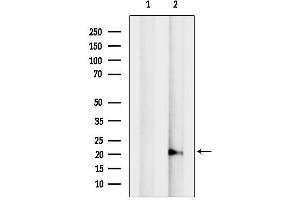 anti-Acireductone Dioxygenase 1 (ADI1) (N-Term) antibody