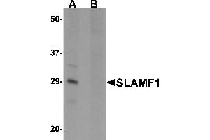 Western blot analysis of SLAMF1 in rat colon tissue lysate with SLAMF1 antibody at 1 µg/mL in (A) the absence and (B) the presence of blocking peptide. (SLAMF1 抗体  (N-Term))