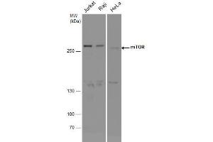 WB Image mTOR antibody detects mTOR protein by western blot analysis. (MTOR 抗体  (Internal Region))