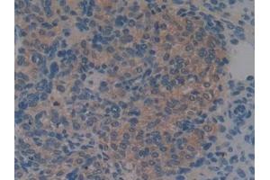 Detection of S100A6 in Mouse Ovary Tissue using Monoclonal Antibody to S100 Calcium Binding Protein A6 (S100A6) (S100A6 抗体  (AA 1-89))
