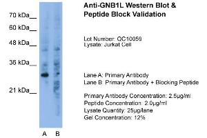 Host:  Rabbit  Target Name:  GNB1L  Sample Type:  Jurkat  Lane A:  Primary Antibody  Lane B:  Primary Antibody + Blocking Peptide  Primary Antibody Concentration:  2. (GNB1L 抗体  (C-Term))