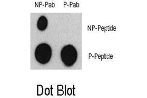 Dot blot analysis of ATF2 (phospho S322) polyclonal antibody  and ATF2 Non Phospho-specific Pab on nitrocellulose membrane. (ATF2 抗体  (pSer322, pSer340))