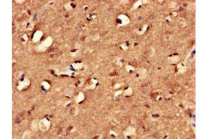 Immunohistochemistry of paraffin-embedded human brain tissue using ABIN7166940 at dilution of 1:100 (MYRIP 抗体  (AA 387-689))
