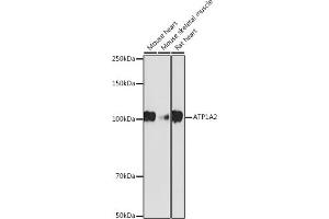 Western blot analysis of extracts of various cell lines, using  antibody (ABIN7265769) at 1:1000 dilution. (ATP1A2 抗体)