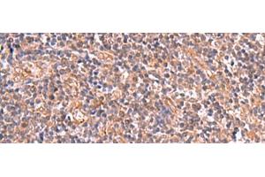 Immunohistochemistry of paraffin-embedded Human tonsil tissue using UBAC1 Polyclonal Antibody at dilution of 1:50(x200)