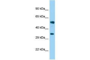 Host: Rabbit Target Name: FAM49B Sample Type: Fetal Brain lysates Antibody Dilution: 1. (FAM49B 抗体  (N-Term))