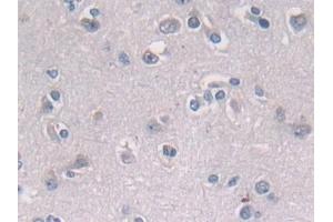 Immunohistochemistry (IHC) image for anti-Proteasome (Prosome, Macropain) 26S Subunit, Non-ATPase, 2 (PSMD2) (AA 645-872) antibody (ABIN7439738)