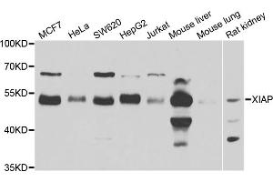 Western blot analysis of extracts of various cell lines, using XIAP antibody (ABIN5974139) at 1/1000 dilution. (XIAP 抗体)