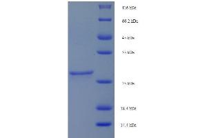 SDS-PAGE (SDS) image for Growth Hormone Releasing Hormone (GHRH) (AA 1-44) protein (His tag) (ABIN1476824)