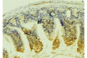 ABIN6278905 at 1/100 staining Mouse colon tissue by IHC-P.