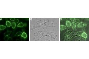 Immunocytochemistry (ICC) image for anti-Tumor Necrosis Factor Receptor Superfamily, Member 19 (TNFRSF19) (AA 75-88), (Extracellular) antibody (ABIN7043868)