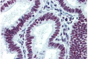Human Uterus: Formalin-Fixed, Paraffin-Embedded (FFPE) (CDKL1 抗体  (AA 259-358))