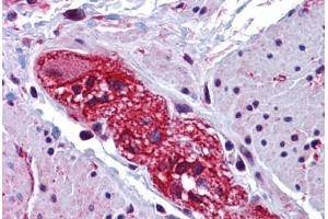 Human Colon, Submucosal Plexus: Formalin-Fixed, Paraffin-Embedded (FFPE) (CABP7 抗体  (N-Term))