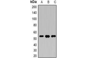 Western blot analysis of DDX39B expression in Hela (A), SKOV3 (B), K562 (C) whole cell lysates. (DDX39B 抗体)