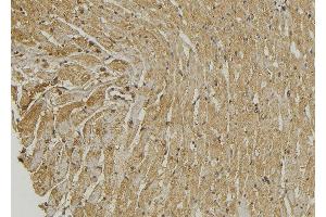 ABIN6272879 at 1/100 staining Mouse muscle tissue by IHC-P.