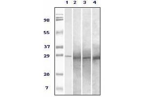 Western Blotting (WB) image for anti-RAB25, Member RAS Oncogene Family (RAB25) antibody (ABIN1108810) (RAB25 抗体)