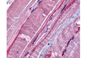 Anti-GRK5 antibody IHC of human skeletal muscle. (GRK5 抗体  (N-Term))