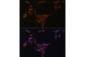 Immunofluorescence analysis of HeLa cells using PPAT Polyclonal Antibody (ABIN6128488, ABIN6146009, ABIN6146010 and ABIN6222409) at dilution of 1:100 (40x lens). (PPAT 抗体  (AA 1-280))