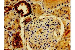 Immunohistochemistry of paraffin-embedded human kidney tissue using ABIN7162672 at dilution of 1:100 (PVALB 抗体  (AA 2-110))