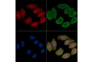 ABIN6262394 and ABIN6266882 staining Hela cells(45 min of heat-shock treatment) by IF/ICC.