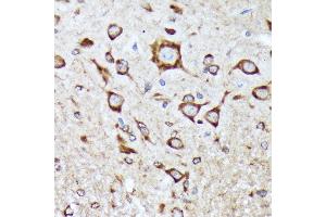 Immunohistochemistry of paraffin-embedded mouse spinal cord using BNIP1 Rabbit mAb (ABIN7265867) at dilution of 1:100 (40x lens). (BNIP1 抗体)