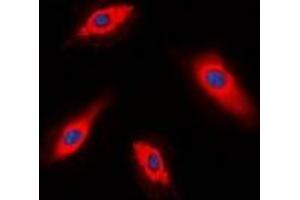Immunofluorescent analysis of ALPK1 staining in HepG2 cells. (ALPK1 抗体  (N-Term))