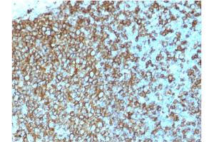 Immunohistochemistry (IHC) image for anti-MHC Class II HLA-DP/DQ/DR (HLA-DP/DQ/DR) antibody (ABIN6941388)