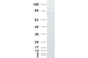 Western Blotting (WB) image for Aryl Hydrocarbon Receptor Nuclear Translocator (ARNT) (Transcript Variant 1) protein (Myc-DYKDDDDK Tag) (ABIN2722733)