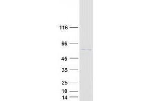 Western Blotting (WB) image for K(lysine) Acetyltransferase 5 (KAT5) (Transcript Variant 3) protein (Myc-DYKDDDDK Tag) (ABIN2723976)
