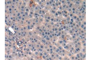 Immunohistochemistry (IHC) image for anti-Mitochondrially Encoded NADH Dehydrogenase 5 (MT-ND5) (AA 425-562) antibody (ABIN7437398)