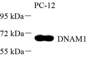Western blot analysis of DNAM1 (ABIN7073379) at dilution of 1: 500