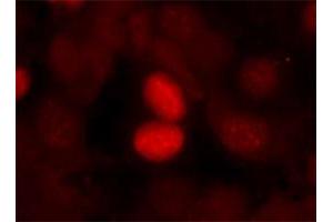 Immunofluorescence staining of manthanol-fixed MCF-7 cells using FOXO1 (phospho S256) polyclonal antibody . (FOXO1 抗体  (pSer256))