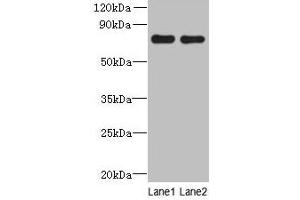 Western blot All lanes: ACTR8 antibody at 16 μg/mL Lane 1: A549 whole cell lysate Lane 2: HCT116 whole cell lysate Secondary Goat polyclonal to rabbit IgG at 1/10000 dilution Predicted band size: 71, 59, 37 kDa Observed band size: 71 kDa (ACTR8 抗体  (AA 35-175))