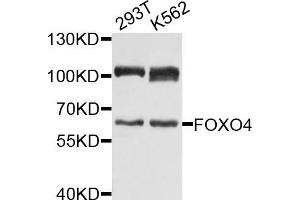 Western blot analysis of extracts of various cell lines, using FOXO4 antibody (ABIN5971698) at 1/1000 dilution. (FOXO4 抗体)