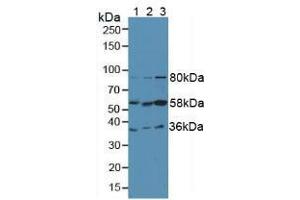 Western blot analysis of (1) Human Liver Tissue, (2) Human HepG2 Cells and (3) Human HeLa cells. (FGL1 抗体  (AA 23-312))
